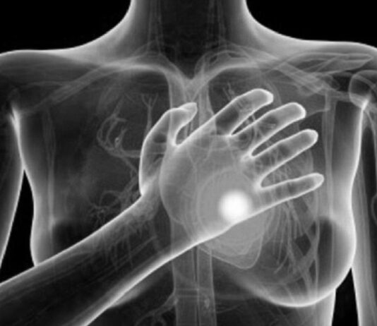 सावधान ! जाडाेमा ३० प्रतिशत बढी हृदयाघातको खतरा