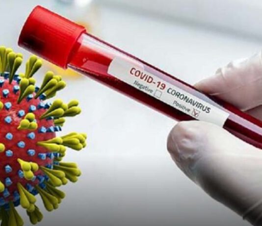 सोल्माका कोरोना संक्रमितः पहिले पिसिआरमा नेगेटिभ, खोटाङमा गर्दा कोरोना पुष्टि