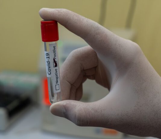 नेपालमा कोरोना संक्रमित ४० हजार ५ सय माथि