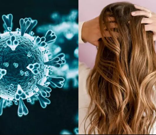 तपाईलाई थाहा छ ? कोरोना लागेपछि कपाल झर्ने यस्तो छ सम्बन्ध