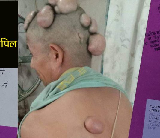 टाउकोभरी वर्षौदेखि हेर्नै नसकिने घाउँ नै घाउँ, उपचारमा सहयोग गरिदिन शम्भुको सबैसँग अपिल